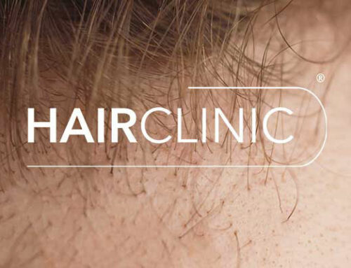 Quel est le rôle des hormones dans la vie des cheveux ?