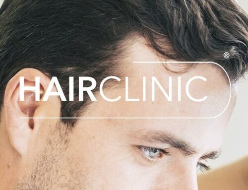 Quel spécialiste pour des greffes de cheveux à Nice ?