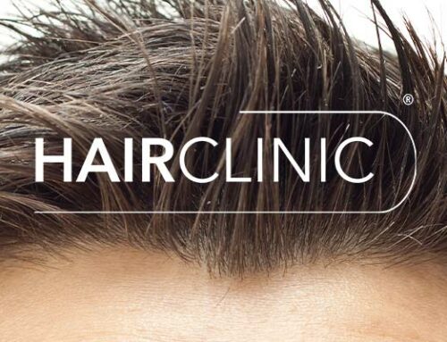 L’Importance de la Première Consultation pour la Chute de Cheveux : Trouver la Solution Adaptée avec HairClinic Nice, Cannes, Marseille