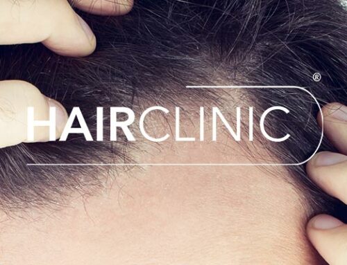 Où faire une greffe de cheveux à Monaco ?
