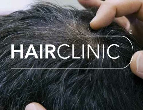 Tout savoir sur les greffes de cheveux – Hairclinic