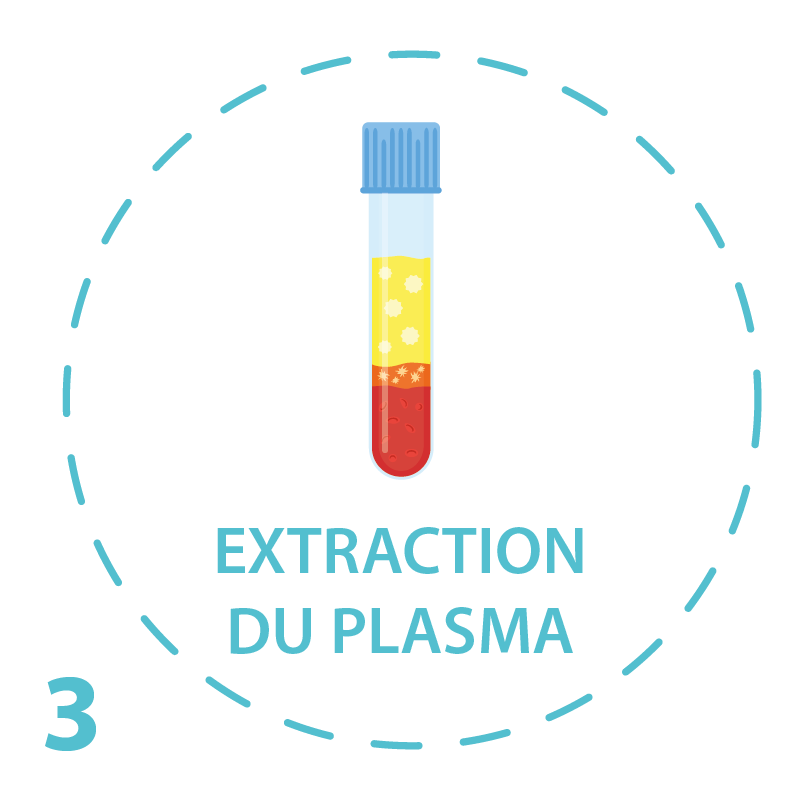 PRP marseille extraction du plasma
