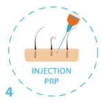 PRP marseille injection