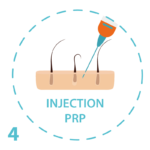 etapes PRP cheveux _Plan de travail 1 copie 3 Injections PRP Nice Marseille Cannes Hairclinic