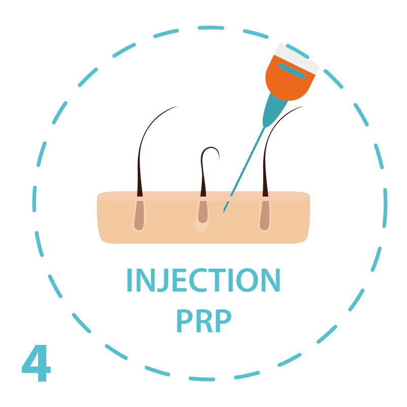 PRP marseille injection