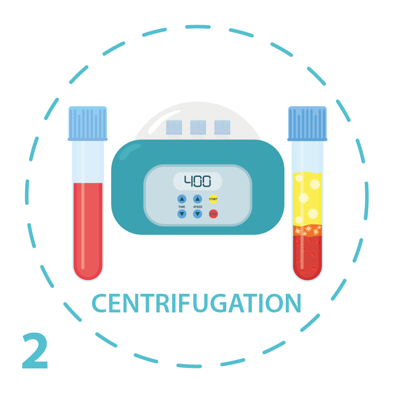 PRP marseille centrifugation