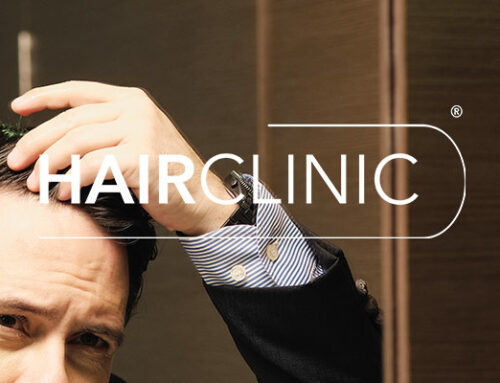Les 5 éléments clés à connaître sur la greffe de cheveux