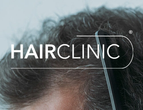 Puis-je faire une greffe de cheveux si je perds encore mes cheveux ?