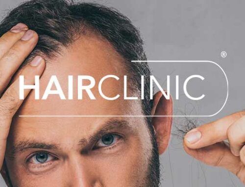 La perte de cheveux chez les hommes : comprendre la calvitie masculine