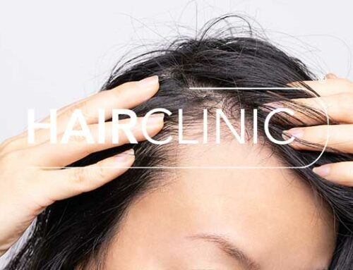 Expertise d’HairClinic Nice dans les Greffes de Cheveux et Injections Capillaires PRP à Nice