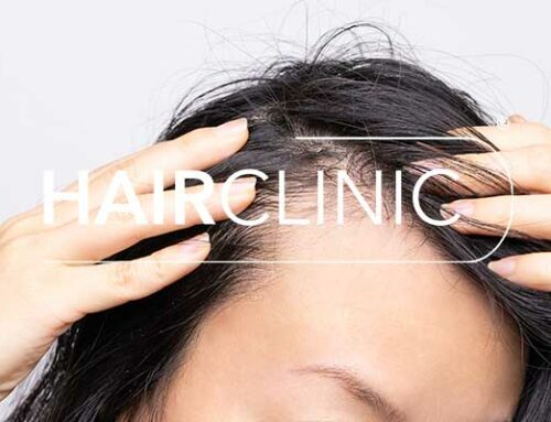 Greffe de cheveux sans rasage pour femme