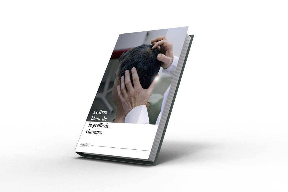 livre-blanc-de-la-greffe-de-cheveux- Livre le cheveu retrouvé - Hairclinic