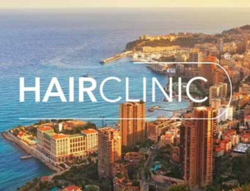 Où faire une greffe de cheveux à Monaco ?