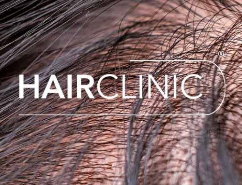 Alopécie androgénétique : comprendre la principale cause de la calvitie