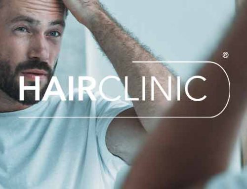 Greffe de cheveux aux tempes : solution efficace contre les tempes dégarnies