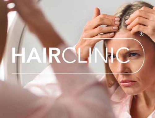 Calvitie Homme à Nice : Quelles solutions contre la chute de cheveux ?