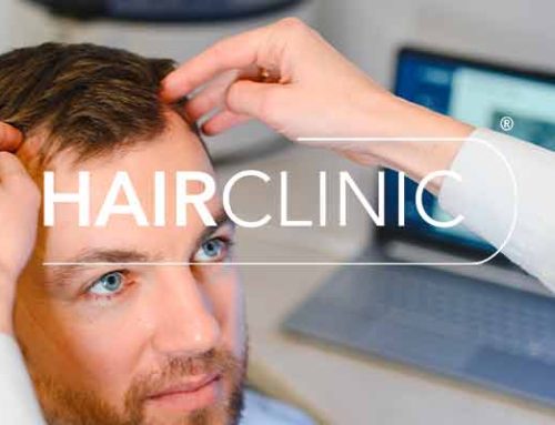 Cheveux clairsemés : que faire ?