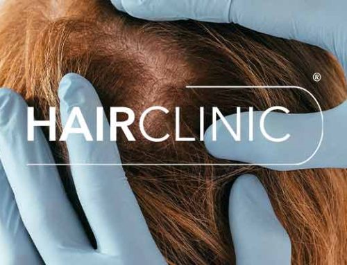 Trou dans les cheveux chez la femme : causes et solutions envisageables