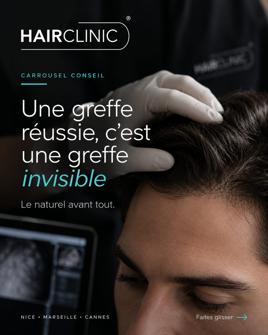 Consultation médicale avant une greffe de cheveux HairClinic
