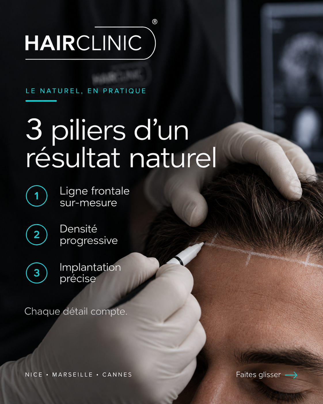 Planification médicale personnalisée d'une greffe de cheveux